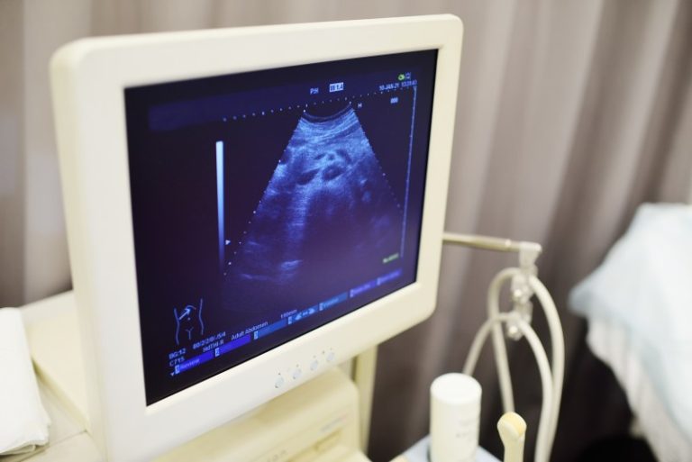 Badanie ultrasonograficzne – historia i znaczenie